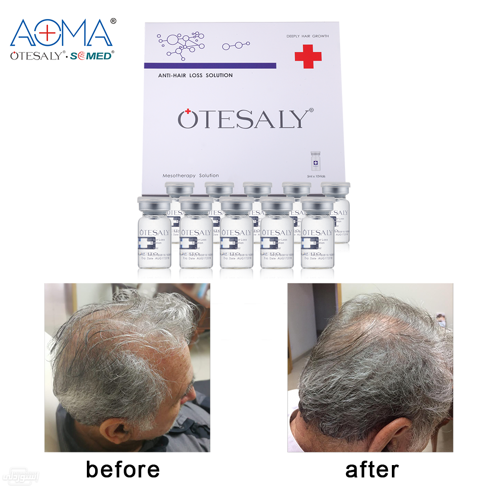 HTB1DkAoavWG3KVjSZFP760aiXXaw