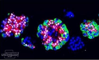 HTB1Nem4XlKw3KVjSZTEq6AuRpXae