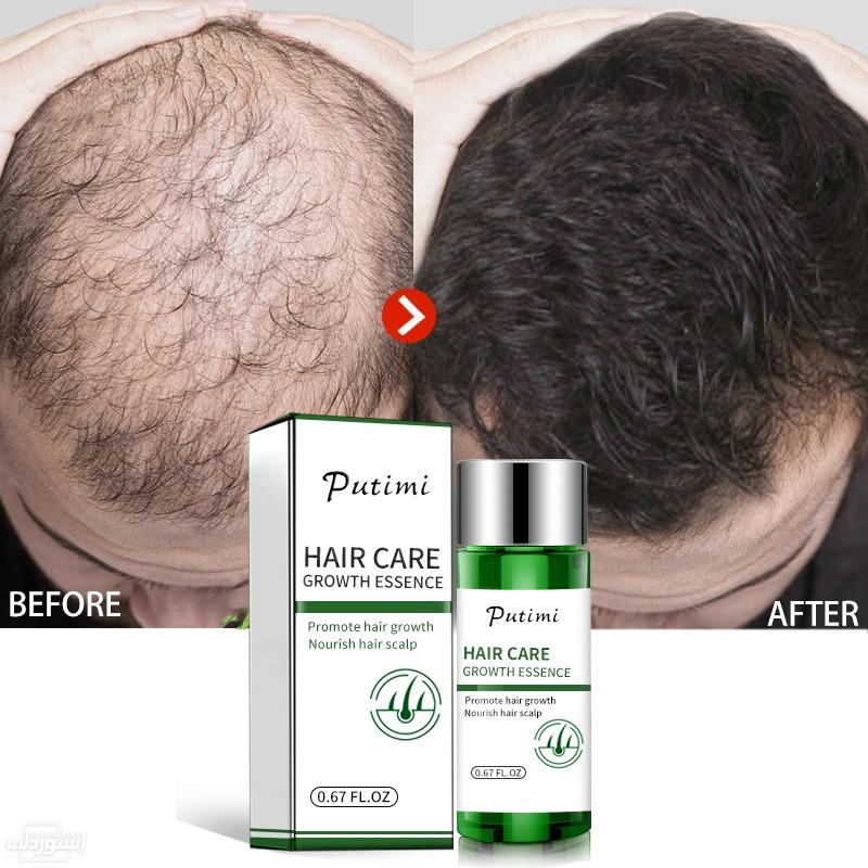 natural-plant-women-men-treatment-hair-l_main-0