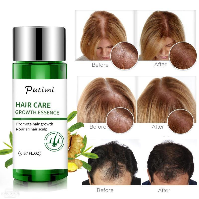 natural-plant-women-men-treatment-hair-l_main-5