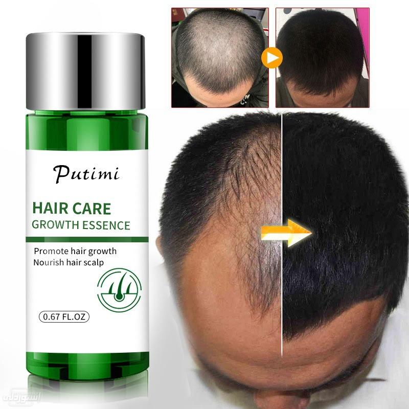natural-plant-women-men-treatment-hair-l_main-6
