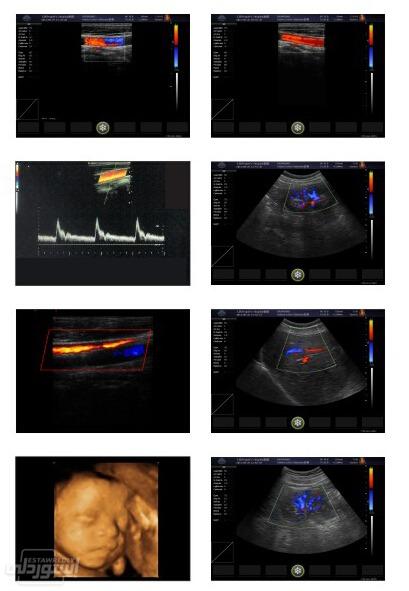 professional-medical-ultrasound-instrume_main-1