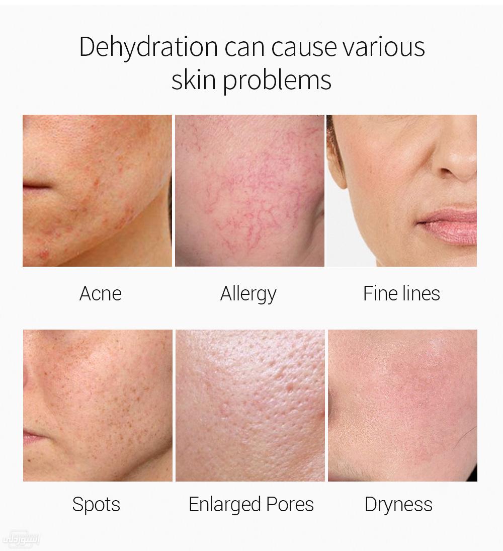 H3110796ca58540b6afd802bf39b126d6X