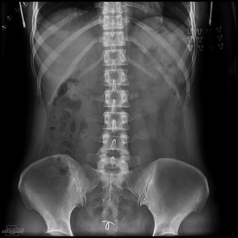 Ud9273e121b584a9b8062365d029afa093