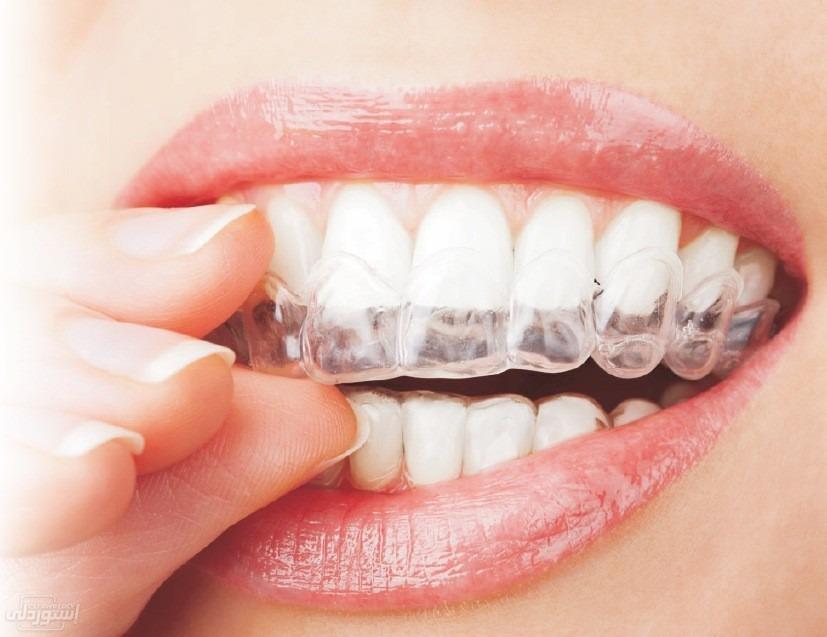 dental-round-or-square-petg-lab-plastic_main-3