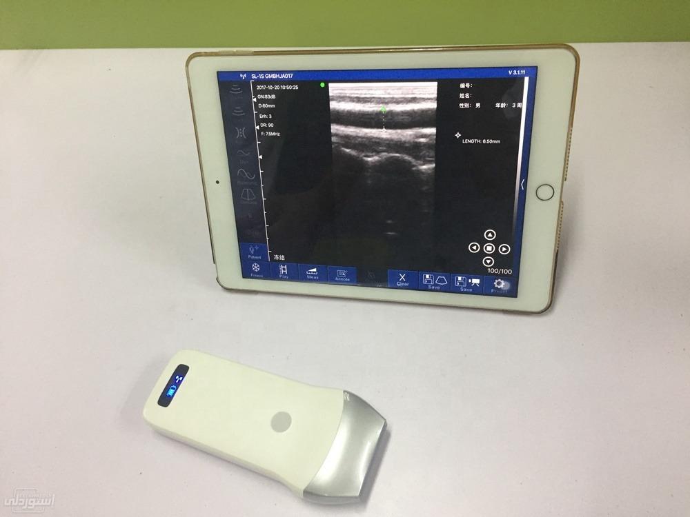 portable-wireless-ultrasound-probe-wifi_main-2