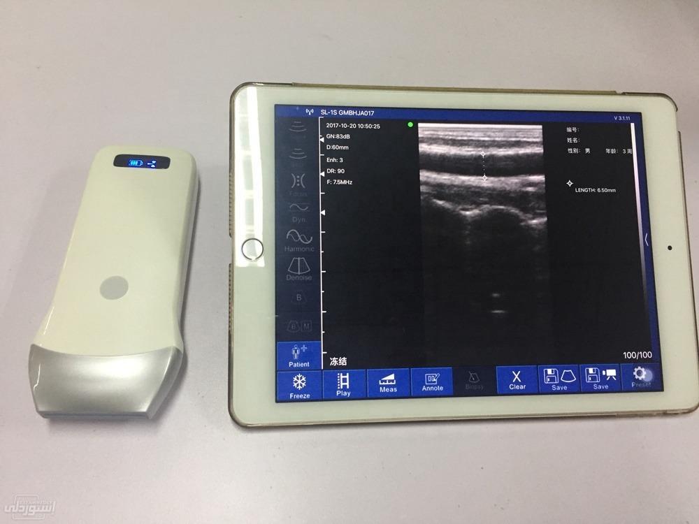 portable-wireless-ultrasound-probe-wifi_main-3