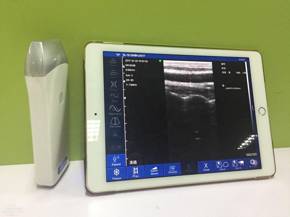 portable-wireless-ultrasound-probe-wifi_main-4
